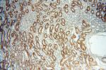 Dysadherin Antibody in Immunohistochemistry (Paraffin) (IHC (P))