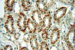 Dysadherin Antibody in Immunohistochemistry (Paraffin) (IHC (P))