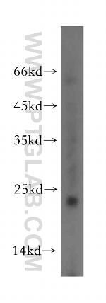 Dysadherin Antibody in Western Blot (WB)