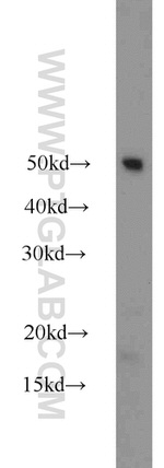 Dysadherin Antibody in Western Blot (WB)