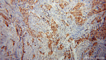 CHFR Antibody in Immunohistochemistry (Paraffin) (IHC (P))