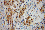 CHFR Antibody in Immunohistochemistry (Paraffin) (IHC (P))