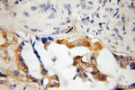 CHFR Antibody in Immunohistochemistry (Paraffin) (IHC (P))
