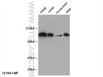 CHFR Antibody in Western Blot (WB)