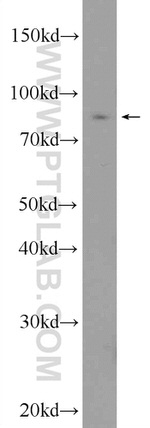 CHFR Antibody in Western Blot (WB)