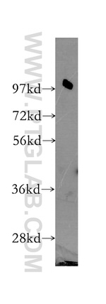 RTF1 Antibody in Western Blot (WB)