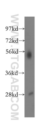 NARF Antibody in Western Blot (WB)