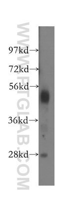 NARF Antibody in Western Blot (WB)