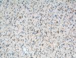 OXCT1 Antibody in Immunohistochemistry (Paraffin) (IHC (P))