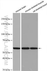 OXCT1 Antibody in Western Blot (WB)