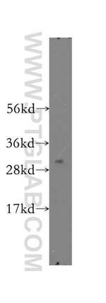SMNDC1 Antibody in Western Blot (WB)