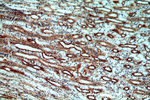 MT3 Antibody in Immunohistochemistry (Paraffin) (IHC (P))