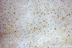 MT3 Antibody in Immunohistochemistry (Paraffin) (IHC (P))