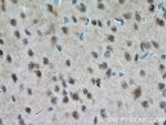 MT3 Antibody in Immunohistochemistry (Paraffin) (IHC (P))
