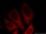 p120 Catenin Antibody in Immunocytochemistry (ICC/IF)