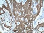 p120 Catenin Antibody in Immunohistochemistry (Paraffin) (IHC (P))