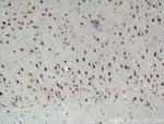 MED8 Antibody in Immunohistochemistry (Paraffin) (IHC (P))