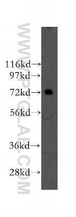 NXF2 Antibody in Western Blot (WB)