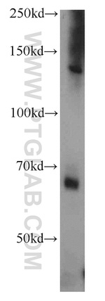 Fibulin 5 Antibody in Western Blot (WB)