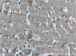 alpha 1 Antichymotrypsin Antibody in Immunohistochemistry (Paraffin) (IHC (P))