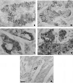E-cadherin Antibody in Immunohistochemistry (Paraffin) (IHC (P))