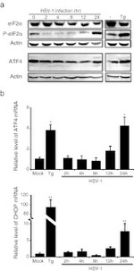 Phospho-EIF2S1 (Ser52) Antibody in Western Blot (WB)