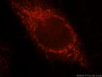 VPS33B Antibody in Immunocytochemistry (ICC/IF)