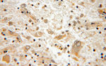 VPS33B Antibody in Immunohistochemistry (Paraffin) (IHC (P))