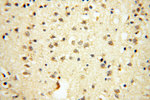 VPS33B Antibody in Immunohistochemistry (Paraffin) (IHC (P))