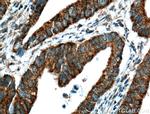 VPS33B Antibody in Immunohistochemistry (Paraffin) (IHC (P))