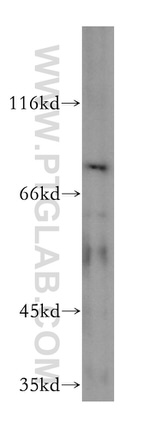 VPS33B Antibody in Western Blot (WB)