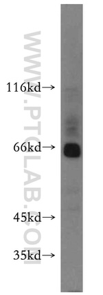 ARMCX2 Antibody in Western Blot (WB)