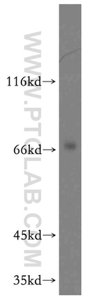 ARMCX2 Antibody in Western Blot (WB)