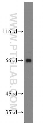 ARMCX2 Antibody in Western Blot (WB)