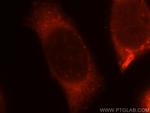 ABHD5 Antibody in Immunocytochemistry (ICC/IF)