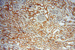 TRIM27 Antibody in Immunohistochemistry (Paraffin) (IHC (P))
