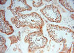 TRIM27 Antibody in Immunohistochemistry (Paraffin) (IHC (P))