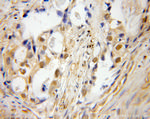 TRIM27 Antibody in Immunohistochemistry (Paraffin) (IHC (P))