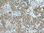 TRIM27 Antibody in Immunohistochemistry (Paraffin) (IHC (P))