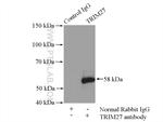 TRIM27 Antibody in Immunoprecipitation (IP)
