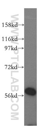 TRIM27 Antibody in Western Blot (WB)
