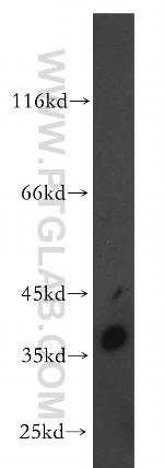 CTRP1 Antibody in Western Blot (WB)