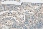 SH3BGRL3 Antibody in Immunohistochemistry (Paraffin) (IHC (P))