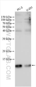 SH3BGRL3 Antibody in Western Blot (WB)