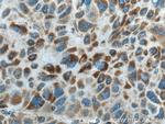 CPOX Antibody in Immunohistochemistry (Paraffin) (IHC (P))