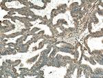 Cathepsin B Antibody in Immunohistochemistry (Paraffin) (IHC (P))