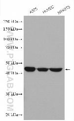 Cathepsin B Antibody in Western Blot (WB)