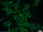 Cathepsin B Antibody in Immunocytochemistry (ICC/IF)