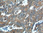 Cathepsin B Antibody in Immunohistochemistry (Paraffin) (IHC (P))