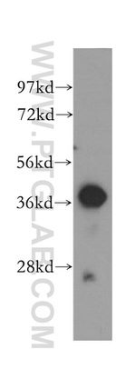 Cathepsin B Antibody in Western Blot (WB)